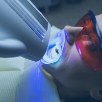 Laser Dental Treatment in Menorca
