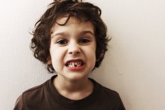 dentista-para-niños-menorca